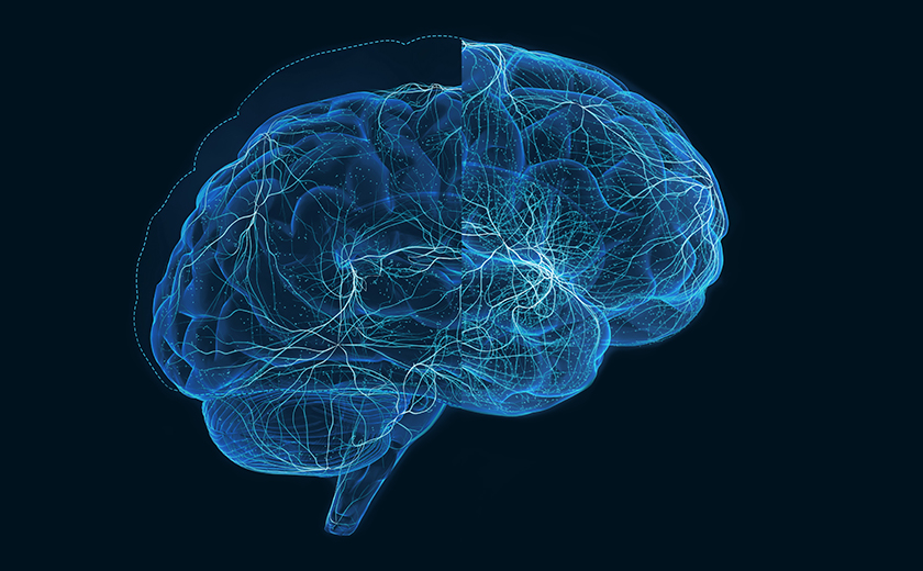 What causes Alzheimers disease?